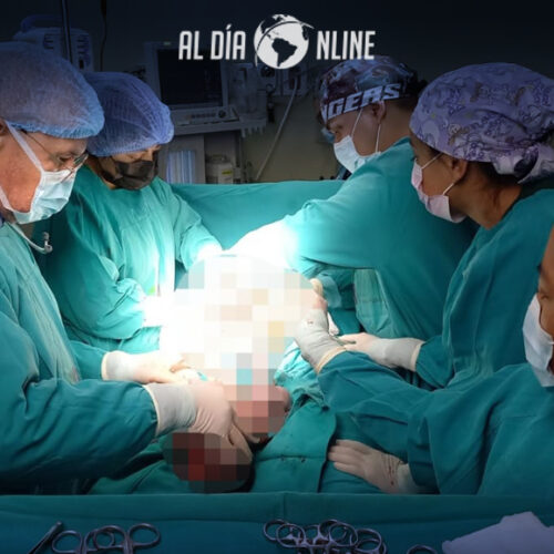 HOSPITAL BÁSICO SIGCHOS ATENDIÓ PARTO DE GEMELAS ORIUDA DE LA PARROQUIA LAS PAMPAS