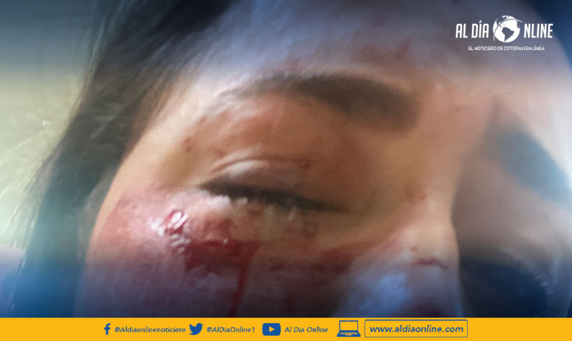 LA ASAMBLEÎSTA VERÓNICA CARRILLO DENUNCIA LA VIOLENTA AGRESIÓN QUE SUFRIÓ EN EL ROSTRO EN UN ASALTO.