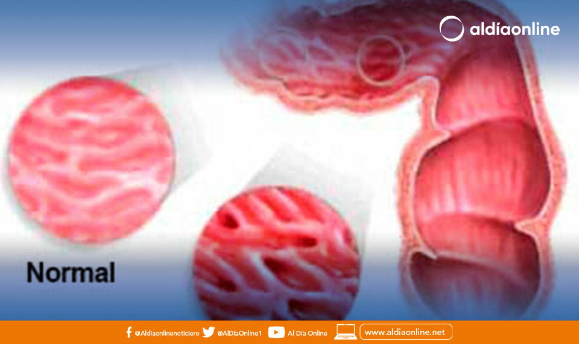 ALIMENTOS PARA LA SALUD DEL COLON