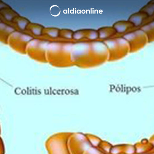 ALIMENTOS PARA LA SALUD DEL COLON