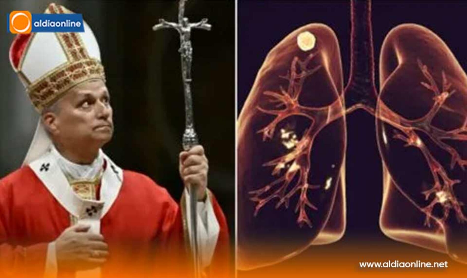 EL PAPA SERÁ INTERVENIDO QUIRÚRGICAMENTE DE UN NÓDULO EN EL PULMÓN EN LOS PRÓXIMOS DÍAS