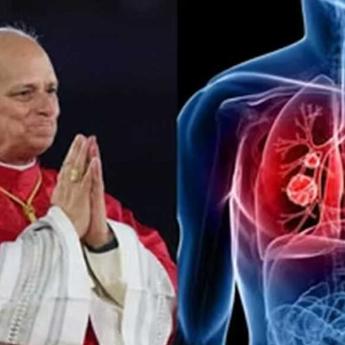EL PAPA SERÁ INTERVENIDO QUIRÚRGICAMENTE DE UN NÓDULO EN EL PULMÓN EN LOS PRÓXIMOS DÍAS